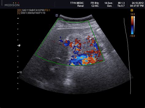 What Does A Liver Ultrasound Look Like Dog Breeds Picture