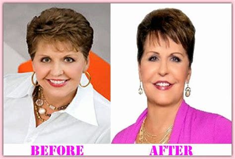 Joyce Meyer Plastic Surgery Before And After Photos Celebrity Plastic Surgery News Before