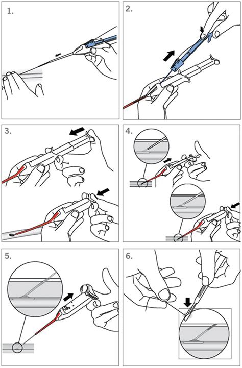 Figure 1 From Safety And Efficacy Of Femoral Artery Closure With The