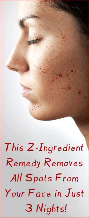 amazing this 2 ingredient remedy removes all spots from your face in just 3 nights face