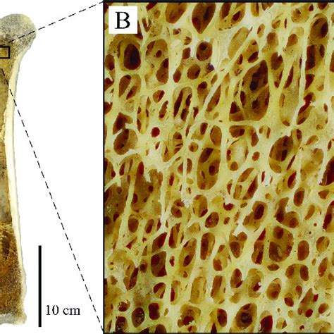 The Main Architectural Features Of Cancellous Bone In The Distal Femur