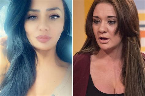 Nhs Boob Job Scrounger Josie Cunningham Reveals Shes Pregnant With Her
