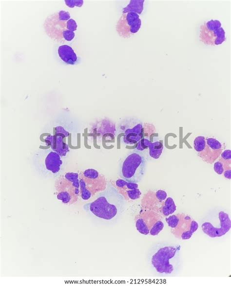 Eosinophils Cell Body Fluid Stock Photo 2129584238 Shutterstock