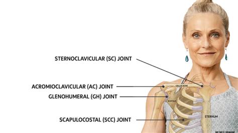 Biomechanics And Treatment Of Acromioclavicular And Sternoclavicular