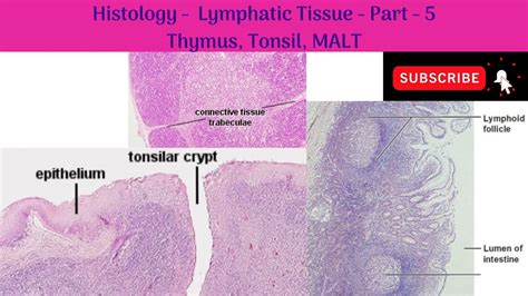 Histology Of Lymphatic Tissue Part 5 Thymus Tonsil Malt Anatomy