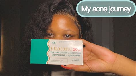 Is Oratane Accutane The Cure To Acne My Acne Journey YouTube