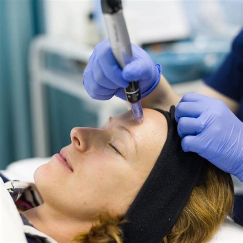 Dermapenmicroneedling Treatment Clinical Skin Care And Laser Clinic