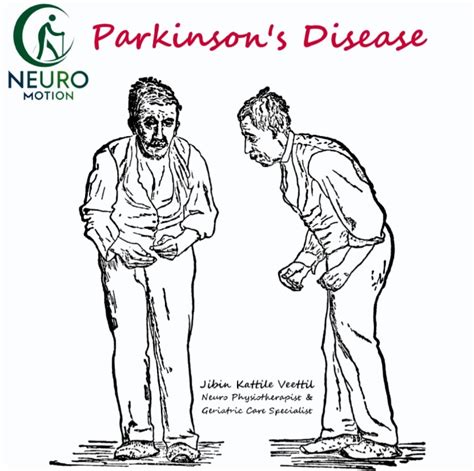 Understanding Parkinsons Disease Causes Mechanisms And Hope