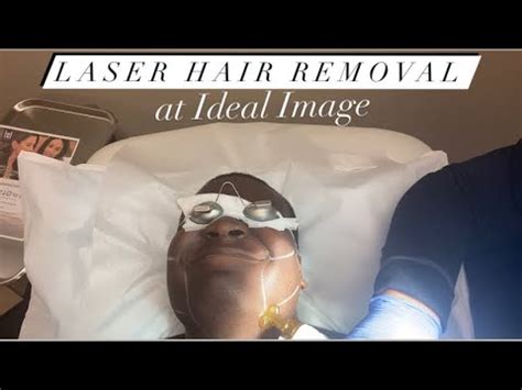 There are different types of laser hair removal machines. FULL FACE LASER HAIR REMOVAL VLOG | Ideal Image ...