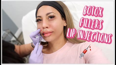 Entire Face Of Botox Filler And Lip Injections Youtube