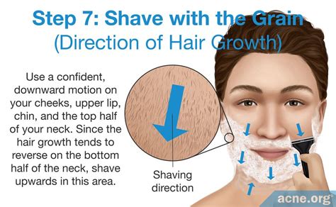 Shaving For Acne Prone People