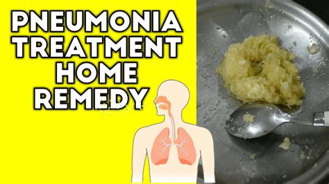 Pneumonia Treatment Home Remedy Best Tips Of 2020 Youtube