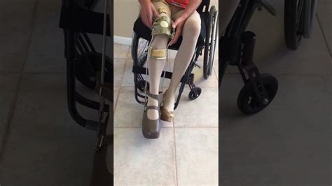 Polio Woman Leg Brace Wheelchair High Heel 5 Youtube
