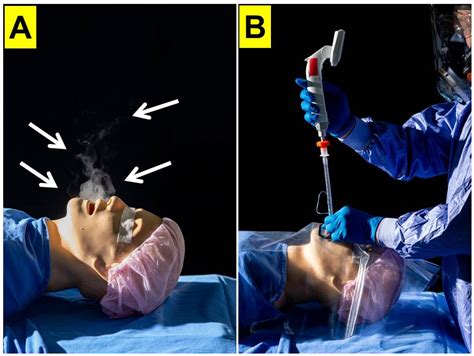 Healthcare Free Full Text Video Assisted Stylet Intubation With A
