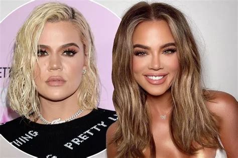 Khloe Kardashian Accused Of Changing Her Face With Surgery After