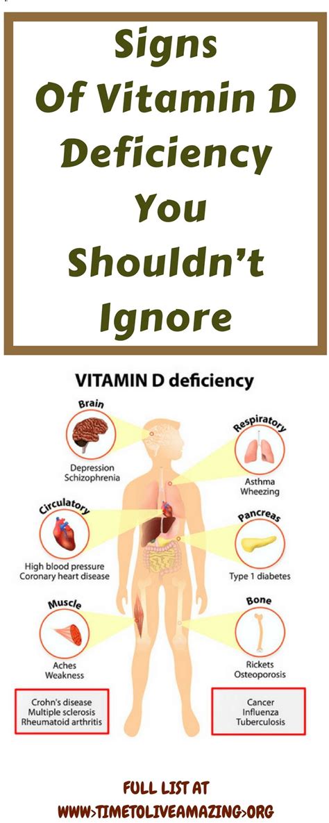 — written by louisa what women need to know. Signs Of Vitamin D Deficiency You Shouldn't Ignore - Time ...