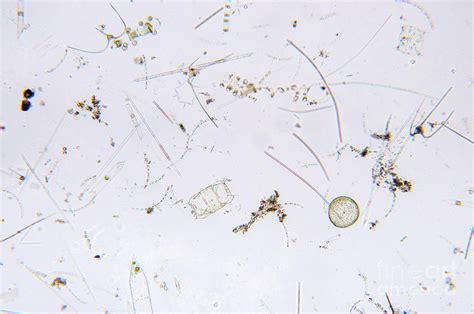 Marine Plankton Photograph By Choksawatdikorn Science Photo Library
