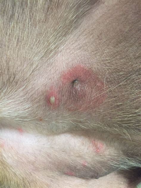 Raised Bumps On The Skin That Are Filled With Pus Pustules The Skin