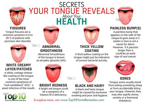 10 Secrets Your Tongue Reveals About Your Health Top 10