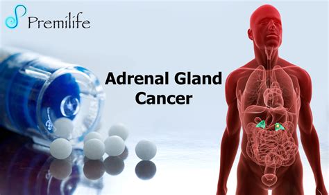 Adrenal Gland Tumor Symptoms