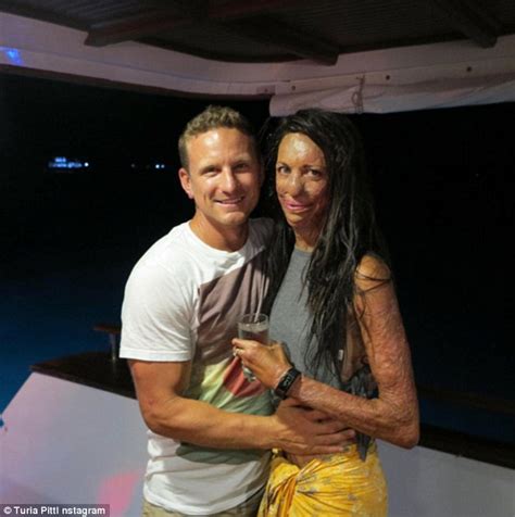 Turia Pitt Shares Sweet Throwback Snap Of Herself With Fianc Michael Hoskin Daily Mail Online