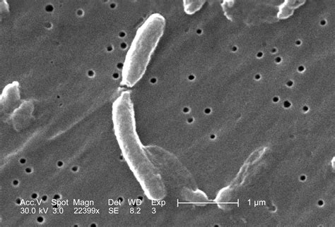 Imagem Gratuita Micrografia Vibrio Cholerae Bactérias