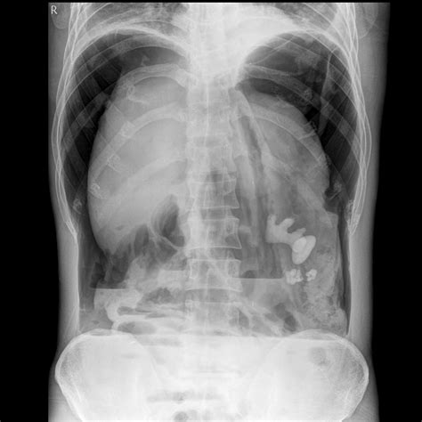 We did not find results for: Left side abdominal pain | General center | SteadyHealth.com