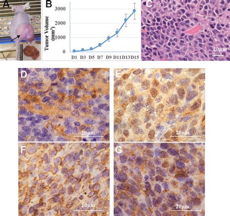 Histology Of The Subcutaneous Tumor Hes Staining G My Xxx Hot Girl