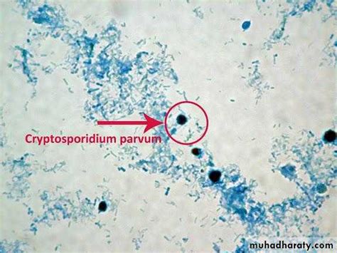 Morphology is not a reliable tool for delineating species within cryptosporidium. Powerpoint4 pptx - د.احمد - Muhadharaty