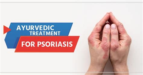 Shuddhi Ayurveda Blog End Your Psoriasis Journey With Ayurvedic Treatment