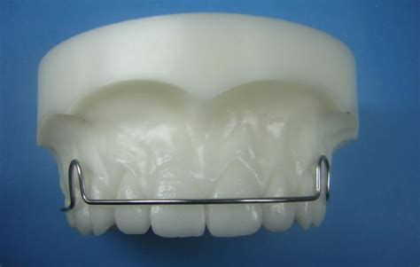 Wraparound Accutech Orthodontic Laboratory Products