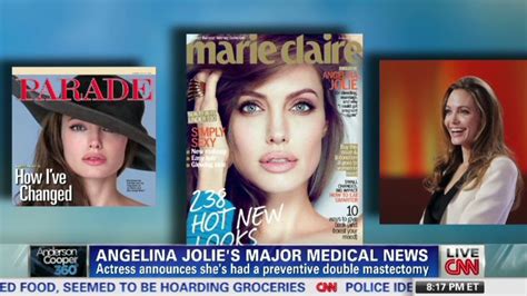 Angelina Jolie Reveals Double Mastectomy Cnn