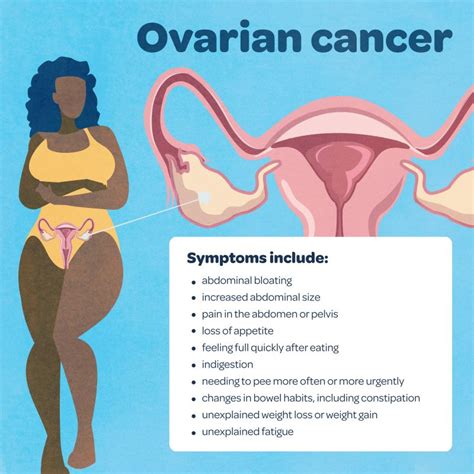 What Is Gynaecological Cancer And What Are The Symptoms Queensland Health