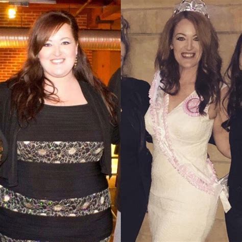 The Most Inspiring Gastric Bypass Before And After Photos