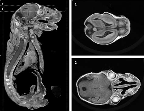 Contrast Enhanced High Resolution Ct Imaging On Tissue Specimens