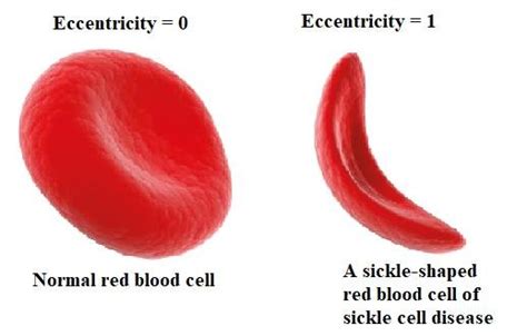 Red blood cells (rbcs) are unique amongst eukaryotic cells as they bear no nucleus or cytoplasmic structures or organelles 4. The difference in eccentricity for normal red blood cell ...