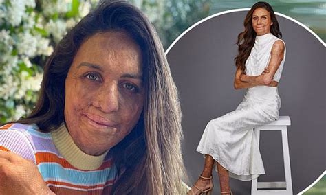 Turia Pitt Reveals Her Minute Rule For Success In The New Year Daily Mail Online