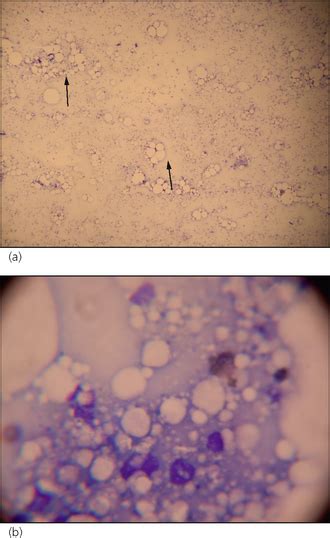 Sterile Pyogranulomatous Nodular Dermatitis Veterian Key