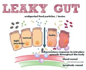 The network quickly expanded beyond california in the following years. leaky-Gut - Inspired Health