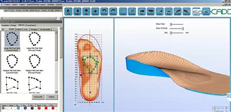 Stages Of 3d Production Of Orthopedic Insoles
