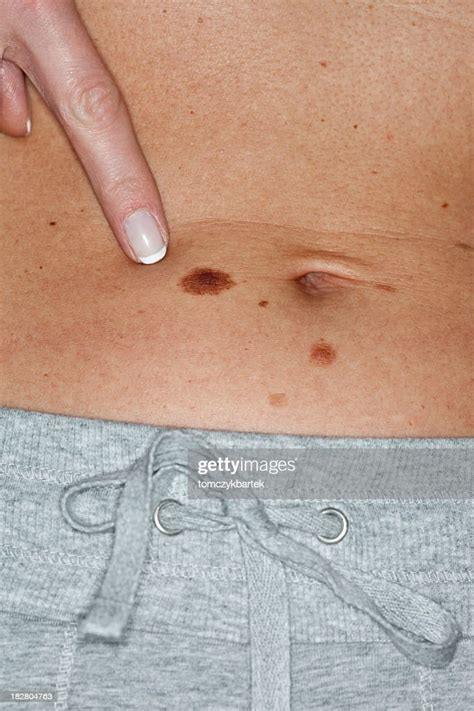 Skin Cancer High Res Stock Photo Getty Images