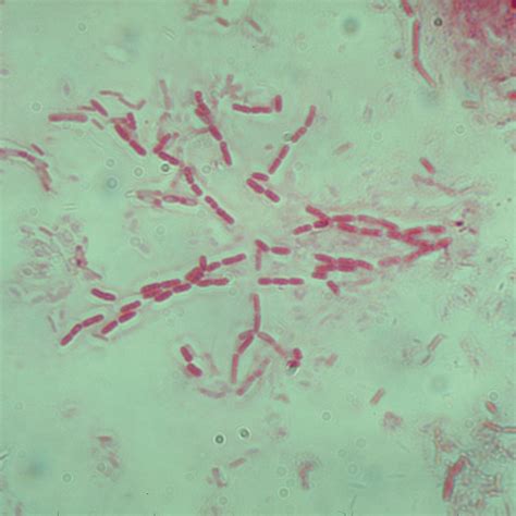 Bacillus Subtilis Living Plate