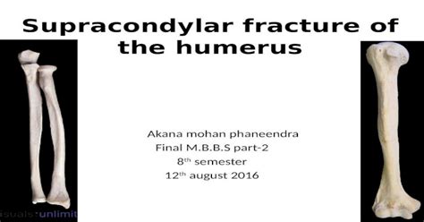 Supracondylar Fracture Of The Humerus By Phaneendra Akana Pptx