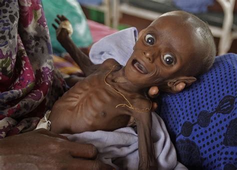 5 Fakta Tentang Kelaparan Di Dunia Yang Bikin Puasa Kita Seolah Nggak
