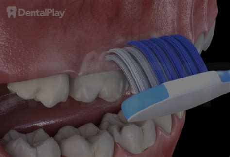 Técnica modificada Bass de cepillado de dientes hilo dental y raspador de lengua Inspiria