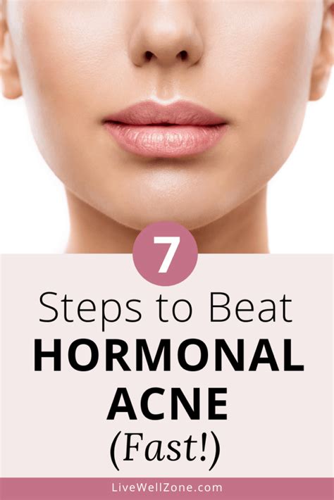 How To Get Rid Of Hormonal Acne Naturally And Fast A 7 Step Plan For Skin
