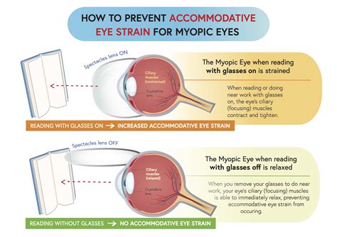 How To Care For Myopic Eyes