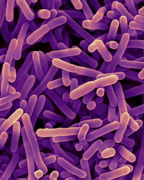 Bifidobacterium Sp Probiotic Photograph By Dennis Kunkel Microscopy