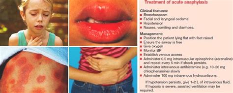 An itchy rash, throat or tongue swelling, shortness of breath, vomiting. Anaphylaxis. Symptoms of Anaphylaxis. Treatment of Anaphylaxis
