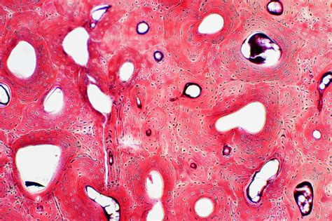 Histologi Jaringan Tulang Kompak Manusia Di Bawah Pandangan Mikroskop